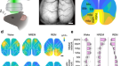 https://media.springernature.com/w136h75/springer-static/image/art%3A10.1038%2Fs41467-022-34720-9/MediaObjects/41467_2022_34720_Fig1_HTML.png