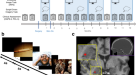 Aversive memory formation in humans involves an amygdala-hippocampus phase code