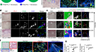 Simple gene signature to assess murine fibroblast polarization