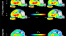 Whole-brain tracking of cocaine and sugar rewards processing