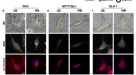 Bcl9 and Pygo synergise downstream of Apc to effect intestinal neoplasia in  FAP mouse models