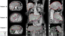 Deep learning-based segmentation of the thorax in mouse micro-CT scans