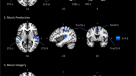 Music in the brain  Nature Reviews Neuroscience