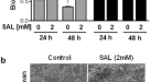 Stress-induced inactivation of the Staphylococcus aureus purine  biosynthesis repressor leads to hypervirulence