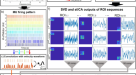 PDF) Specificity of surface EMG recordings for gastrocnemius during upright  standing