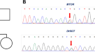 Frontiers  Case Report: Low-Level Maternal Mosaicism of a Novel CREBBP  Variant Causes Recurrent Rubinstein-Taybi Syndrome in Two Siblings of a  Chinese Family