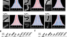 L-form conversion in Gram-positive bacteria enables escape from phage  infection