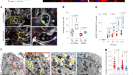 Restoration of the molecular clock is tumor suppressive in neuroblastoma