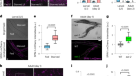 The metabolite alpha-ketobutyrate extends lifespan by promoting peroxisomal  function in C. elegans
