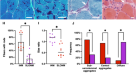 Molecular signatures of inherited and acquired sporadic late onset