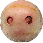 Rotationslappen, bds. bei zwei Defekten