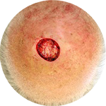 Rotationslappen, von vier Seiten