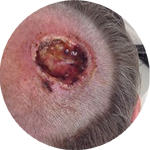 Sekundäre Wundheilung