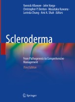 語学・辞書・学習参考書 Scleroderma Scleroderma: From Pathogenesis to Comprehensive Management