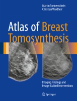 健康・医学 Atlas of Breast Surgical Techniques Atlas of Breast