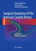 Surgical Anatomy of the Internal Carotid Artery: An Atlas for Skull Base Surgeons [ハードカバー] Castelnuovo， Paolo、 Dallan， Iacopo; Tschabitscher， Manfred