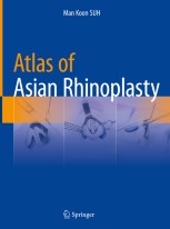 健康・医学 atlas of asian rhinoplasty Atlas of Asian Rhinoplasty | SpringerLink