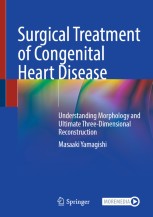 Surgical Treatment of Congenital Heart Disease: Understanding