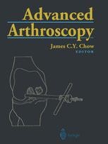 Advanced Arthroscopy | SpringerLink