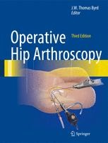Rehabilitation of the Hip | Springer Nature Link