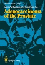 Adenocarcinoma of the Prostate | Springer Nature Link