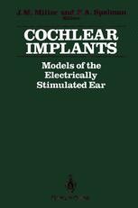 Representations of Speech Features with Cochlear Implants | Springer ...