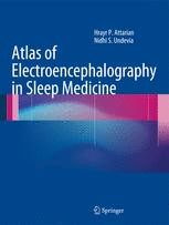 Atlas of Electroencephalography. Awake and sleep EEG