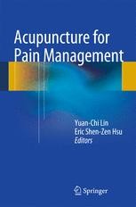 Acupuncture For Pain Management | SpringerLink