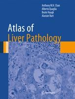健康・医学 The Liver: Biology and Pathobiology 5th Ovid - Liver, The: Biology and Pathobiology | Wolters Kluwer