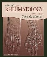 健康・医学 A Colour Atlas of Rheumatoid Hand 健康・医学 A Colour Atlas of Rheumatoid Hand Hand Rheumatoid