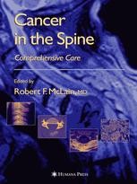 Cancer in the Spine: Comprehensive Care | SpringerLink Cancer in the Spine: Comprehensive Care | SpringerLink