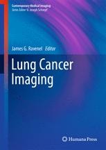 Lung Cancer Imaging | SpringerLink