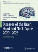 洋書 Expert ddx brain and spine ExpertDDx: Brain and Spine: 9780323443081: Medicine & Health