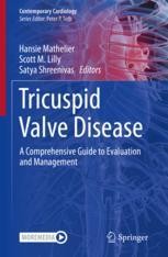 Tricuspid Valve Disease: A Comprehensive Guide to Evaluation and ...