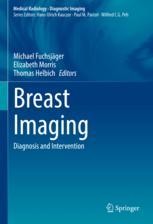 2024-25 秋冬新作  ハイブランドの Techniques MRI: Breast and SpringerLink | Indications フライロッド