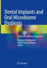 Microbial Principles of Peri-Implant Infections | Springer Nature Link