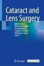 Posterior Subcapsular Cataract | Springer Nature Link