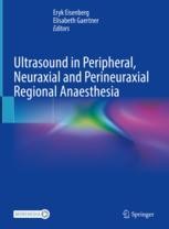 邦楽 INVITATION TO ANESTHESIA Ultrasound in Peripheral, Neuraxial and Perineuraxial