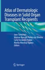 Atlas of Organ Transplantation (DVDなし） 978-3-031-13335-0.jpg