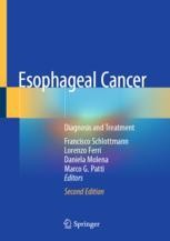 Immunotherapy in Esophageal Cancer | SpringerLink