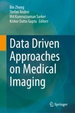 Generative Adversarial Networks for Data Augmentation | Springer Nature ...