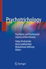 Androgenetic Alopecia | SpringerLink