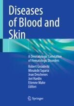 Primary Cutaneous Lymphomas: Classification | Springer Nature Link