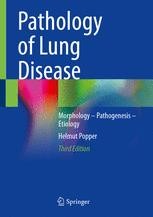 Lung Tumors | Springer Nature Link