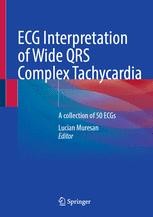 ECG 26 | Springer Nature Link