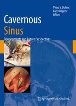 洋書 Anatomy and Surgery of the Cavernous Sin Surgical Anatomy of the Cavernous Sinus | SpringerLink