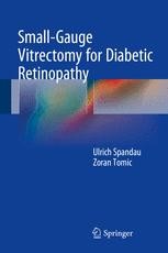 健康・医学 Small-Gauge Vitrectomy for Diabetic Advanced Proliferative Diabetic Retinopathy with Tractional