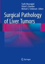 Surgical Pathology of Liver Tumors | SpringerLink Surgical Pathology of Liver Tumors | SpringerLink
