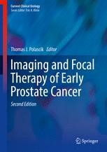【中古】 Prostate Cancer: A Patient’s Guide 2015/SPRINGER NATURE/Rene Sotelo 中古】 Prostate Cancer: A Patient's Guide 2015/SPRINGER
