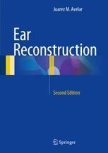 Ear Reconstruction | Springer Nature Link